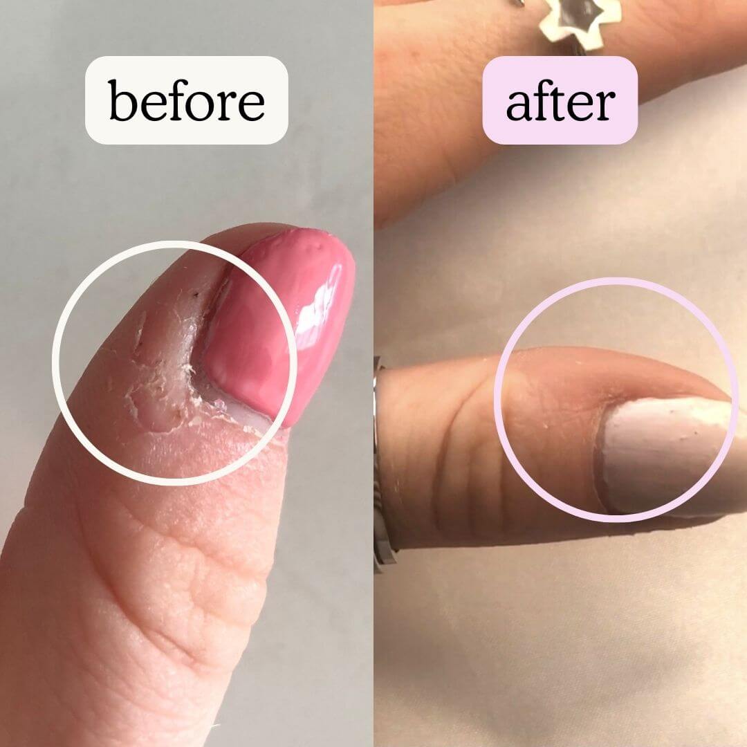 Anillo de plata contra el mal de ojo y la ansiedad